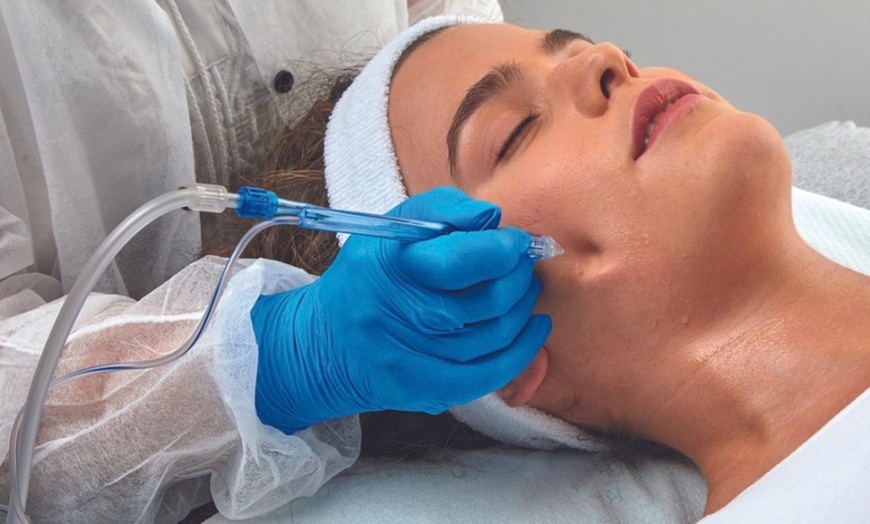 Image 4: Up to 49% Off on Facial at Mynd Spa