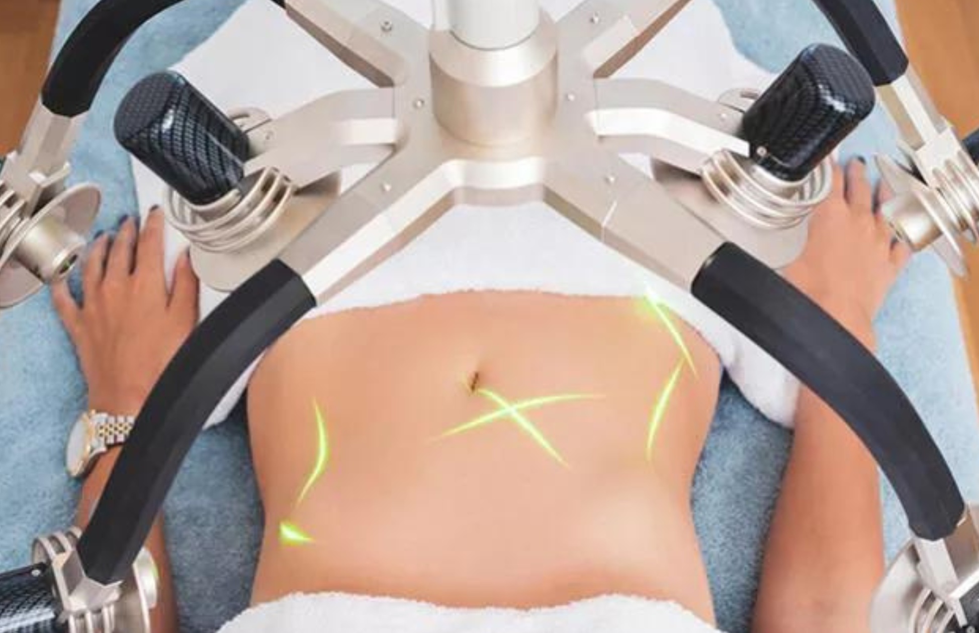 Choose Between 6 or 8 Zerona Fat Reduction Sessions