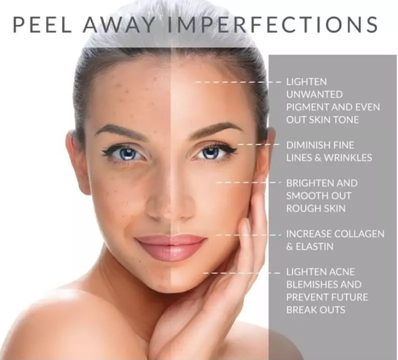 Up to 50% Off on Chemical Peel at NYC Oasis Spa - Primary Image