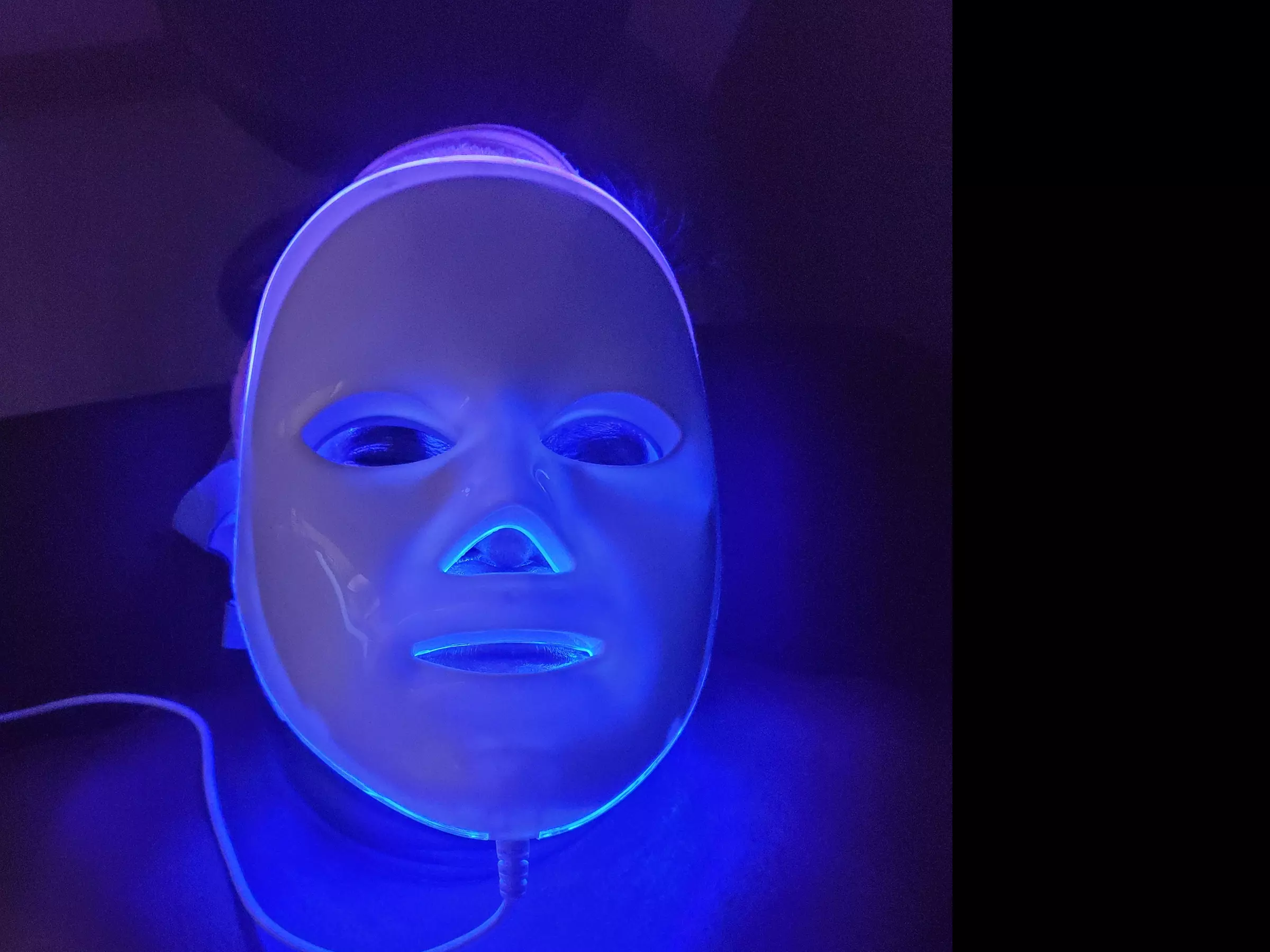 Up to 40% Off on HydraFacial at Adorn Beauty by Syeda - Second Medium