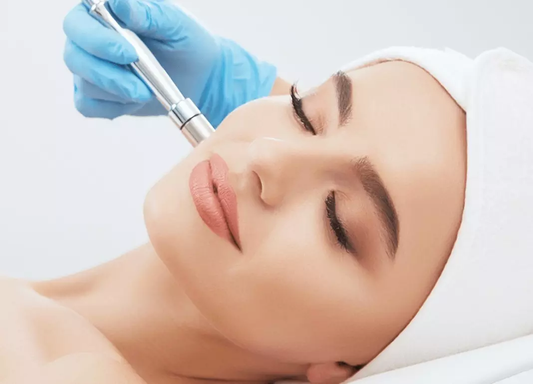Up to 72% Off on Microdermabrasion at Beach Beauty Spa - Second Medium