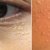 Image 4: Refresh Your Skin With a 30 Min Session or Get a Follow-Up