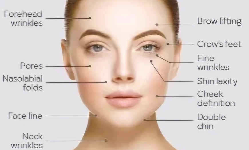 Image 6: Lift & Define: One Mid or Lower Face HIFU Face Lift