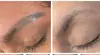 Permanent Makeup & Microblading Removal Kit + Free Saline Removal Certification Up to 50%Off @National Permanent