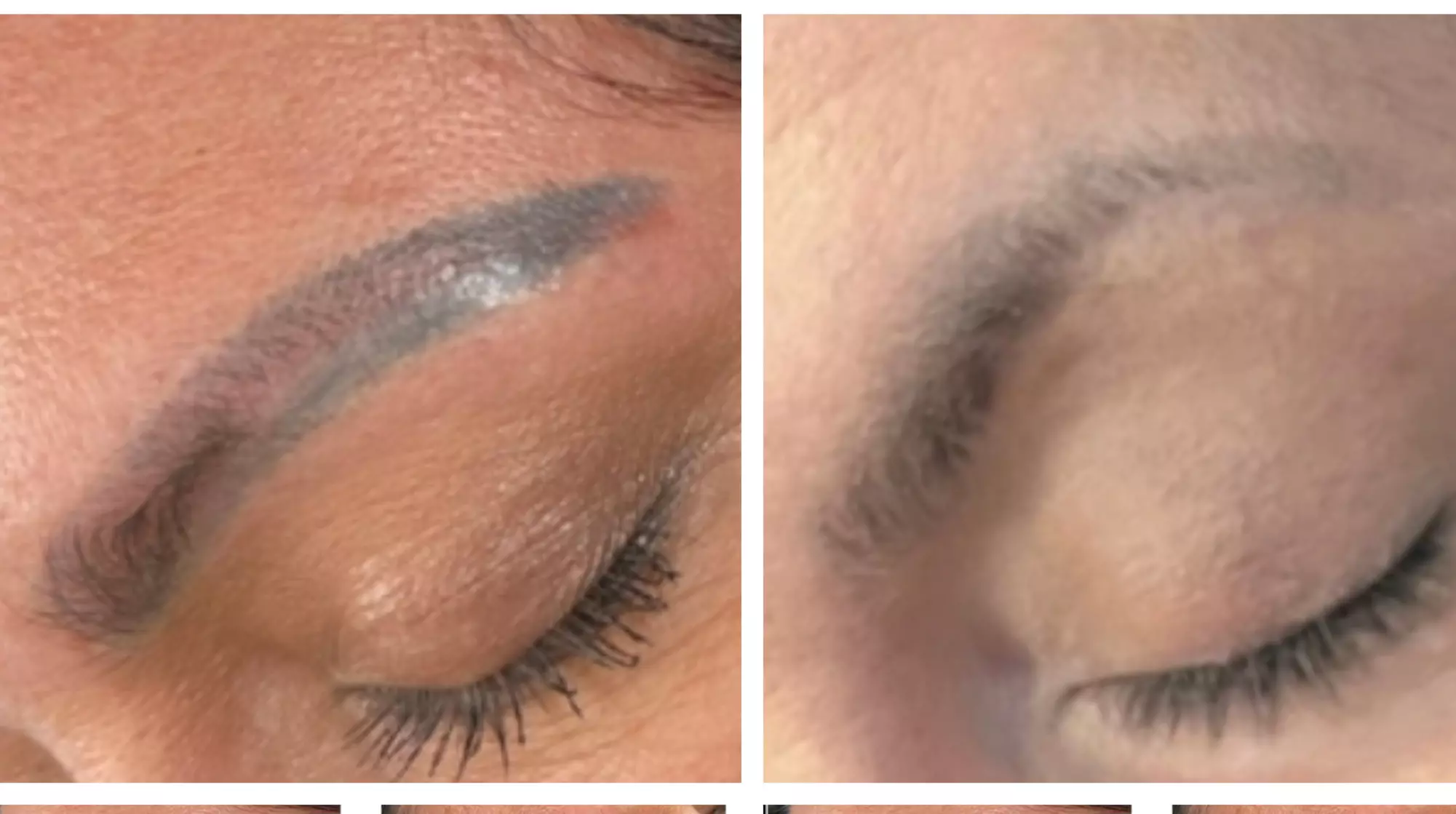 Permanent Makeup Removal Kit with Free Microblading Training