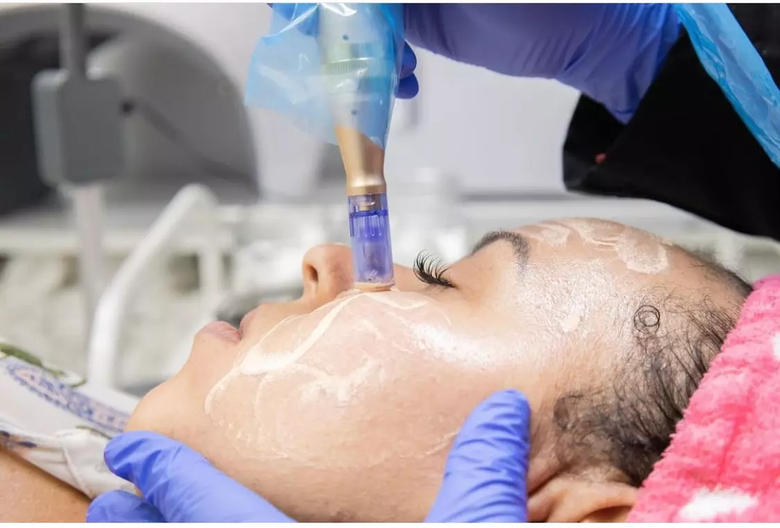 Up to 40% Off on Facial at All in Beauty Institute and Spa Miami - Primary Image