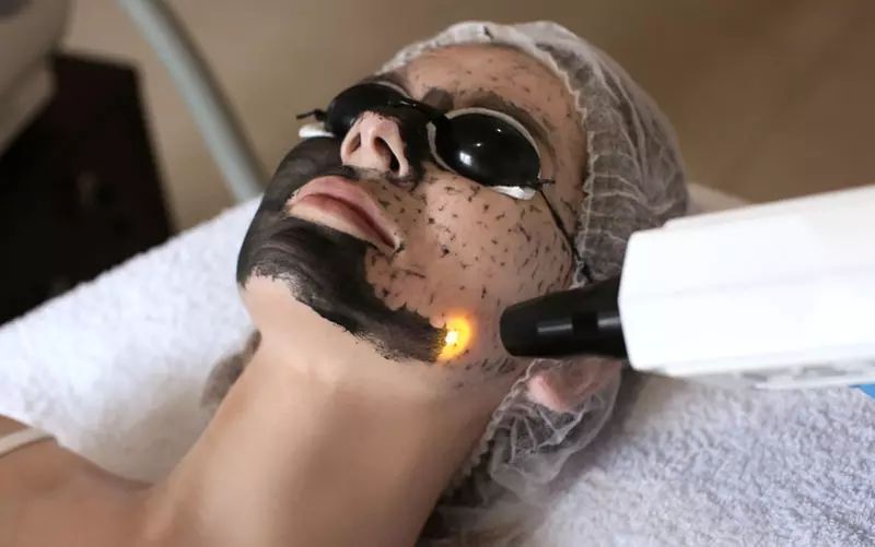 Transform with DermAesthetix's Carbon Laser Peel Facial Options, up to 30% off - Primary Image