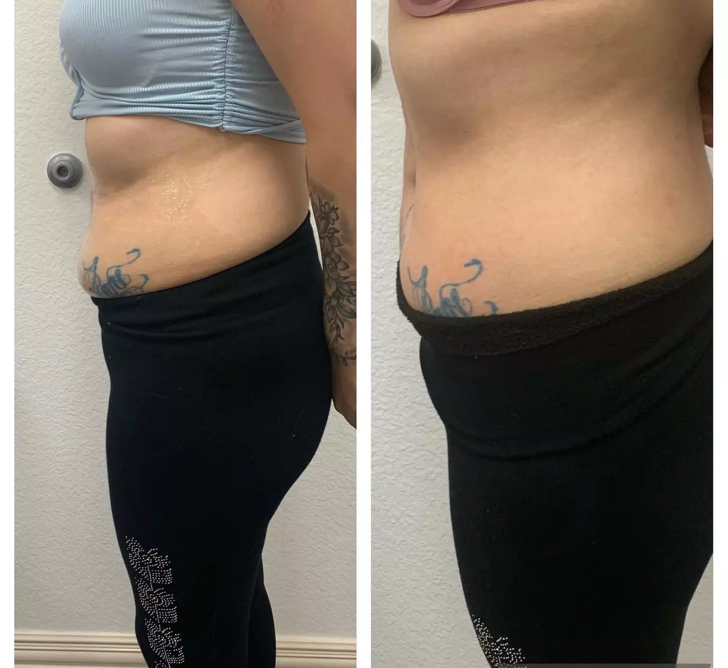 Up to 60% Off on Body Sculpting at Beauty Aesthetics Lounge LLC - Primary Image