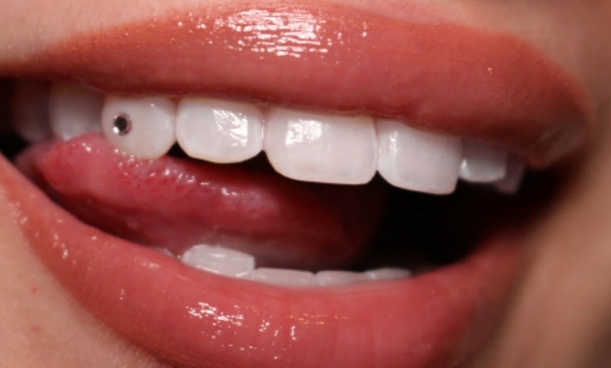 Swarovski Crystal Tooth Gem: Add Elegance to Your Smile