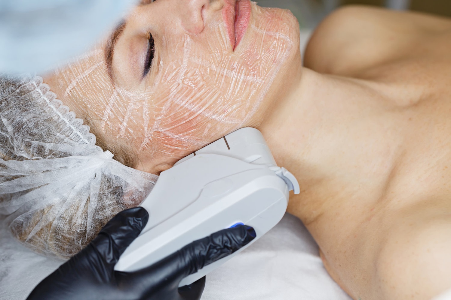 Up to 80% Off on Ultherapy / Ultrasonic Facial at Clinica Med & Beauty Lounge by Nora