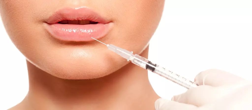 Restylane, Sculptra, Radiesse and Kysse for a Fresh Look