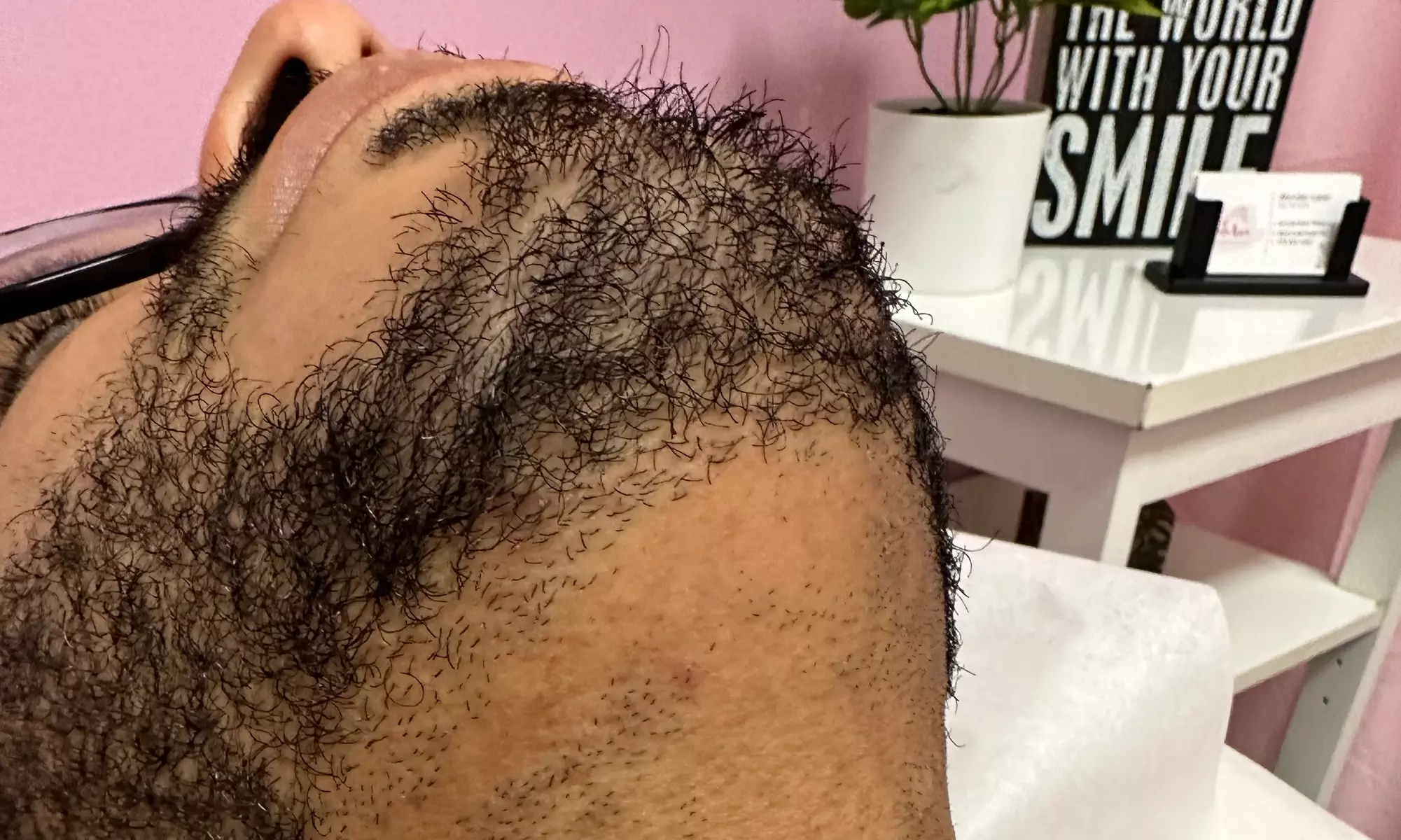 Up to 29% Off on Laser Hair Removal at Wonder Laser - Primary Image