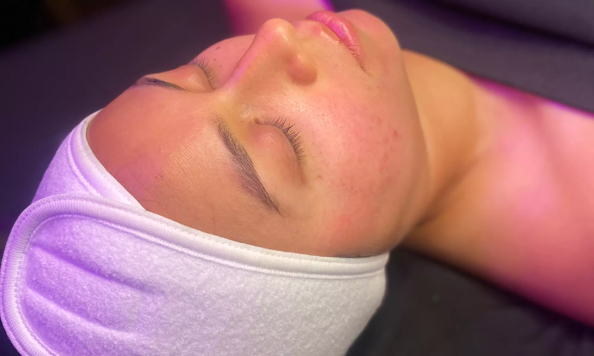 Experience rejuvenation with Raines Esthetics' customized facial options, offering up to 44% off for a glowing skin journey. - Second Medium