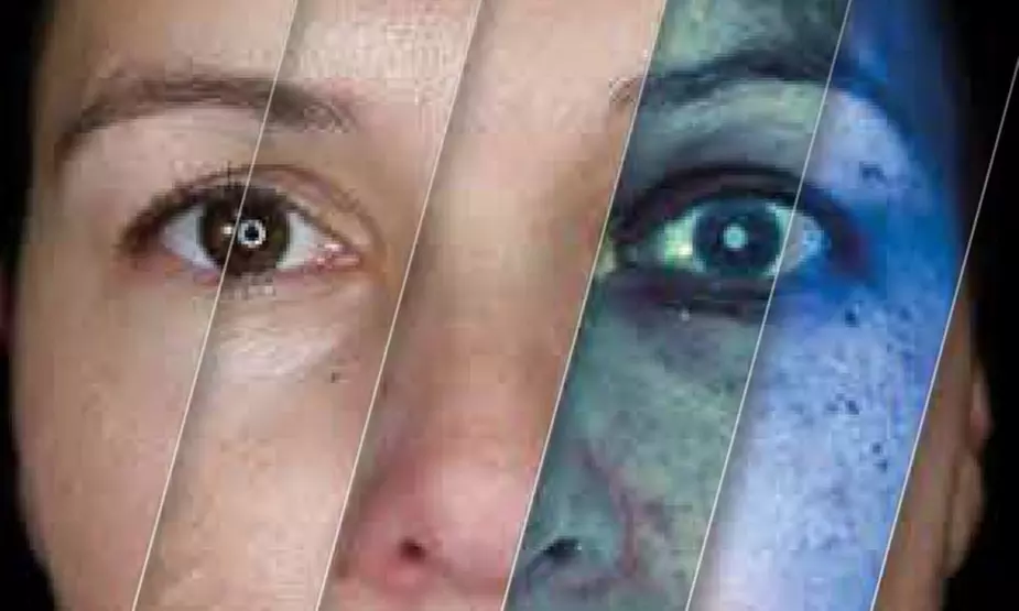 Up to 50% Off on Alma IQ Facial Analysis Service at Bella Skin Center - Primary Image