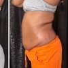 Image 2: Up to 37% Off on Cavitation at Extreme body sculpting