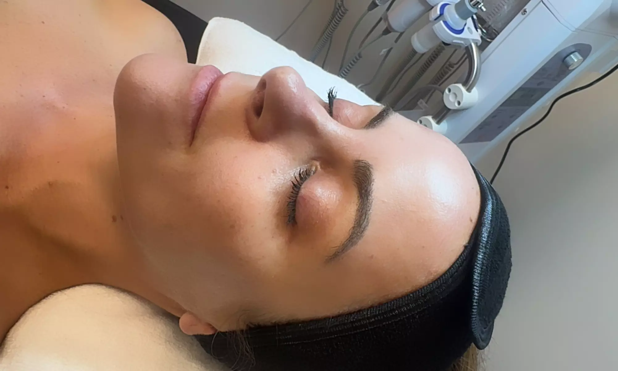 Up to 50% Off on Microdermabrasion at Soriaskincare