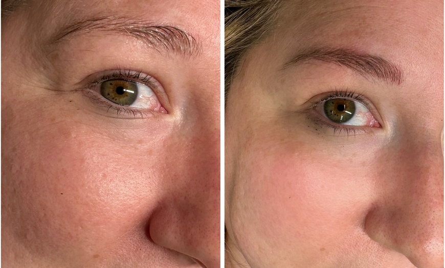 Image 1: One Ombre Microshading Session or One Microblading Session