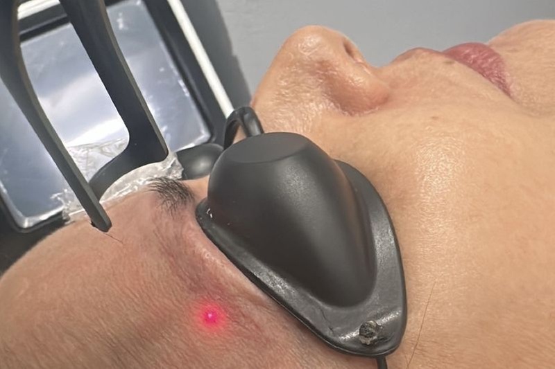 Up to 46% Off on Tattoo Removal at Vida Spa