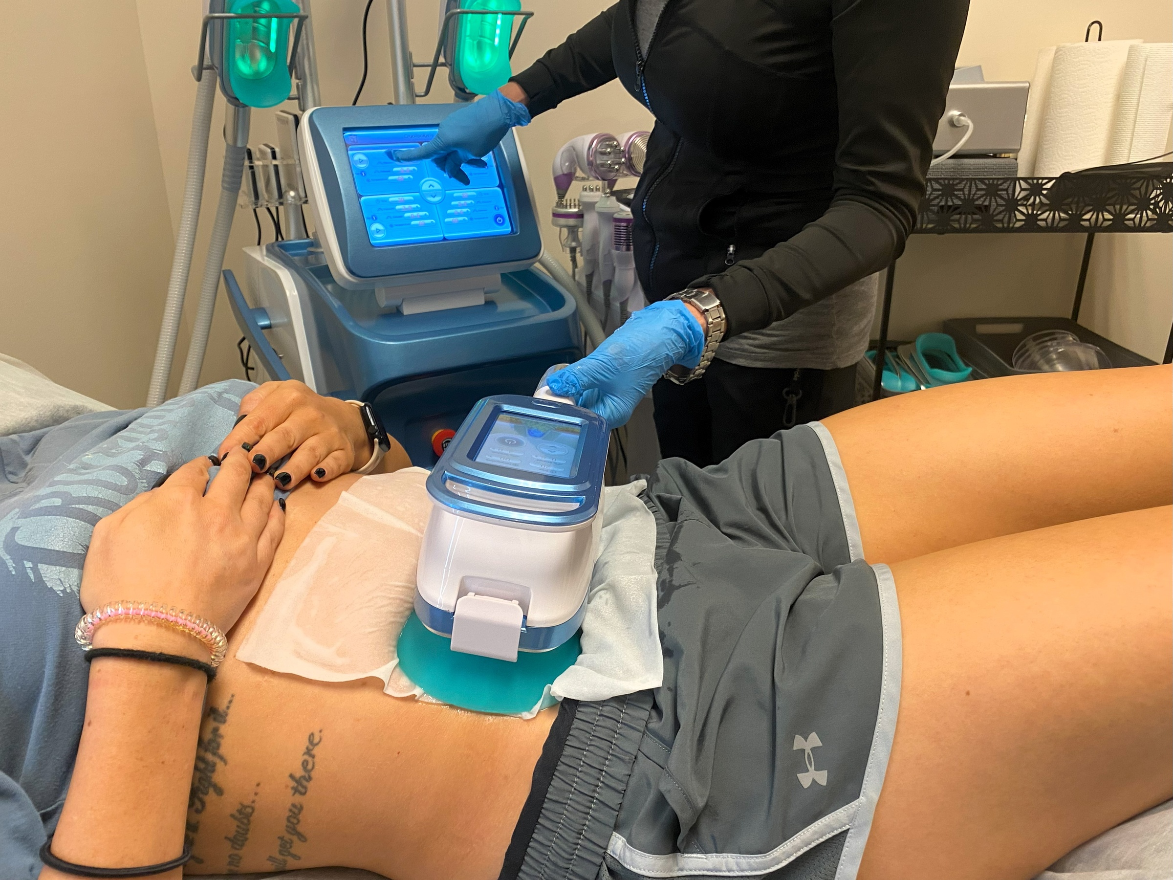 Cryolipolysis Fat Freeze with Cavitation Treatments