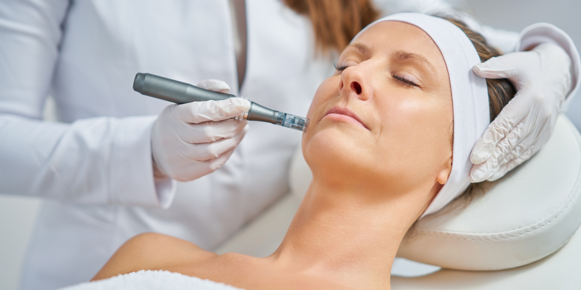 Up to 40% Off on Micro-Needling 