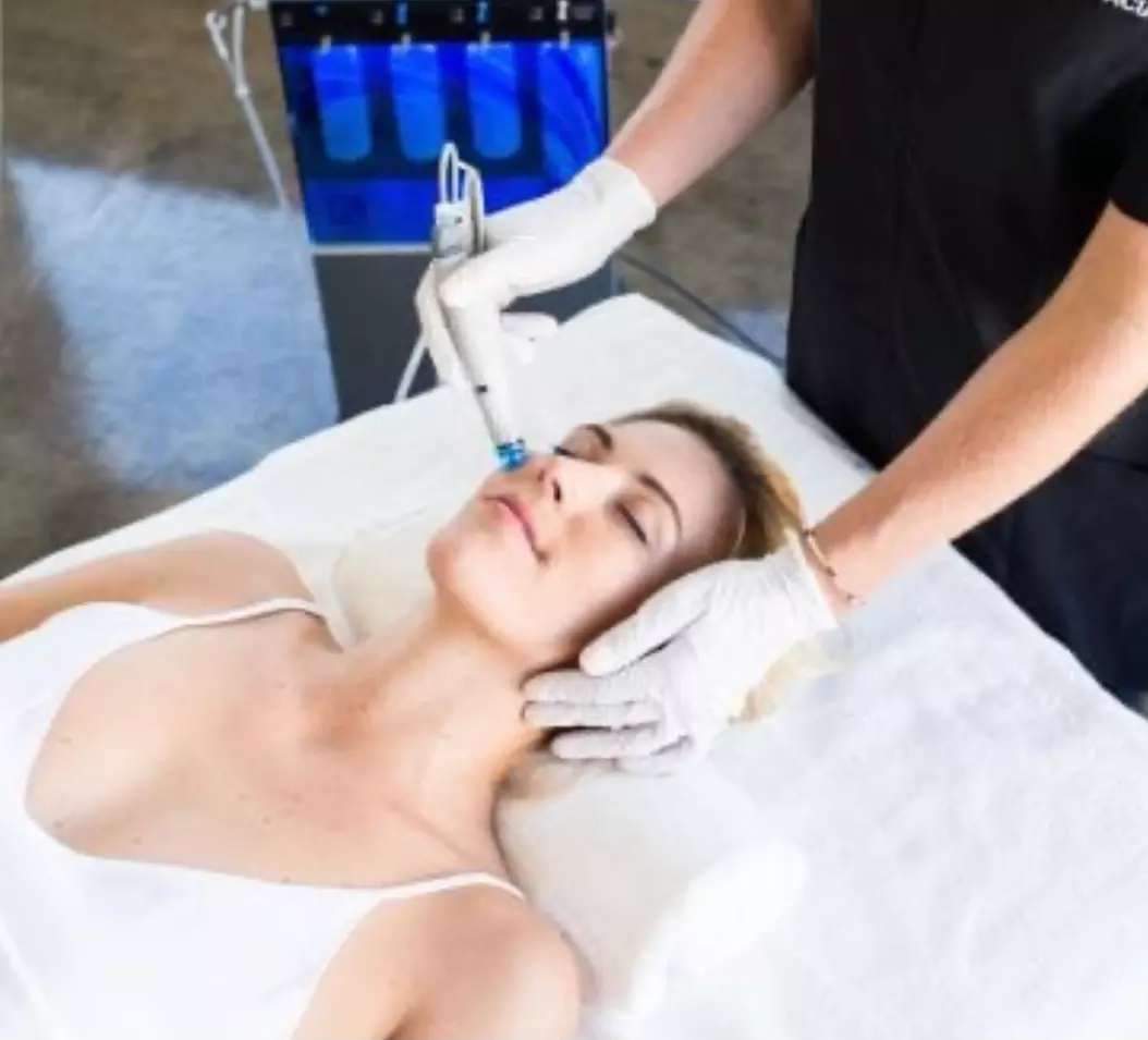 One Hydrafacial for Face, Neck, and/or Chest at Milan Aesthetics Medical Spa (Up to 92% Off) - Primary Image