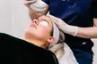 Up to 50% Off on Facial - Thermal Rejuvenation at UK Aesthetics Lounge - Image 2