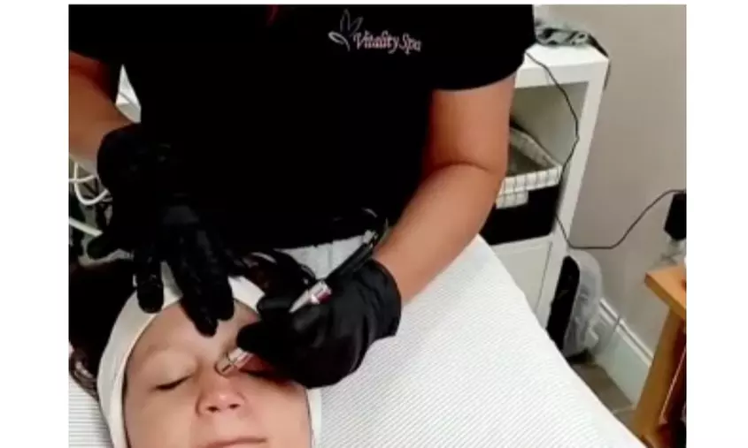Up to 57% Off on Microdermabrasion at Vitality Spa Lighthouse Point - Second Medium