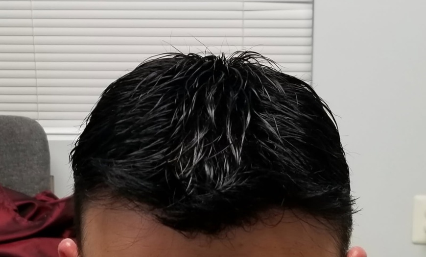 Image 2: $369 or $265 Worth of Non Surgical Hair Replacement