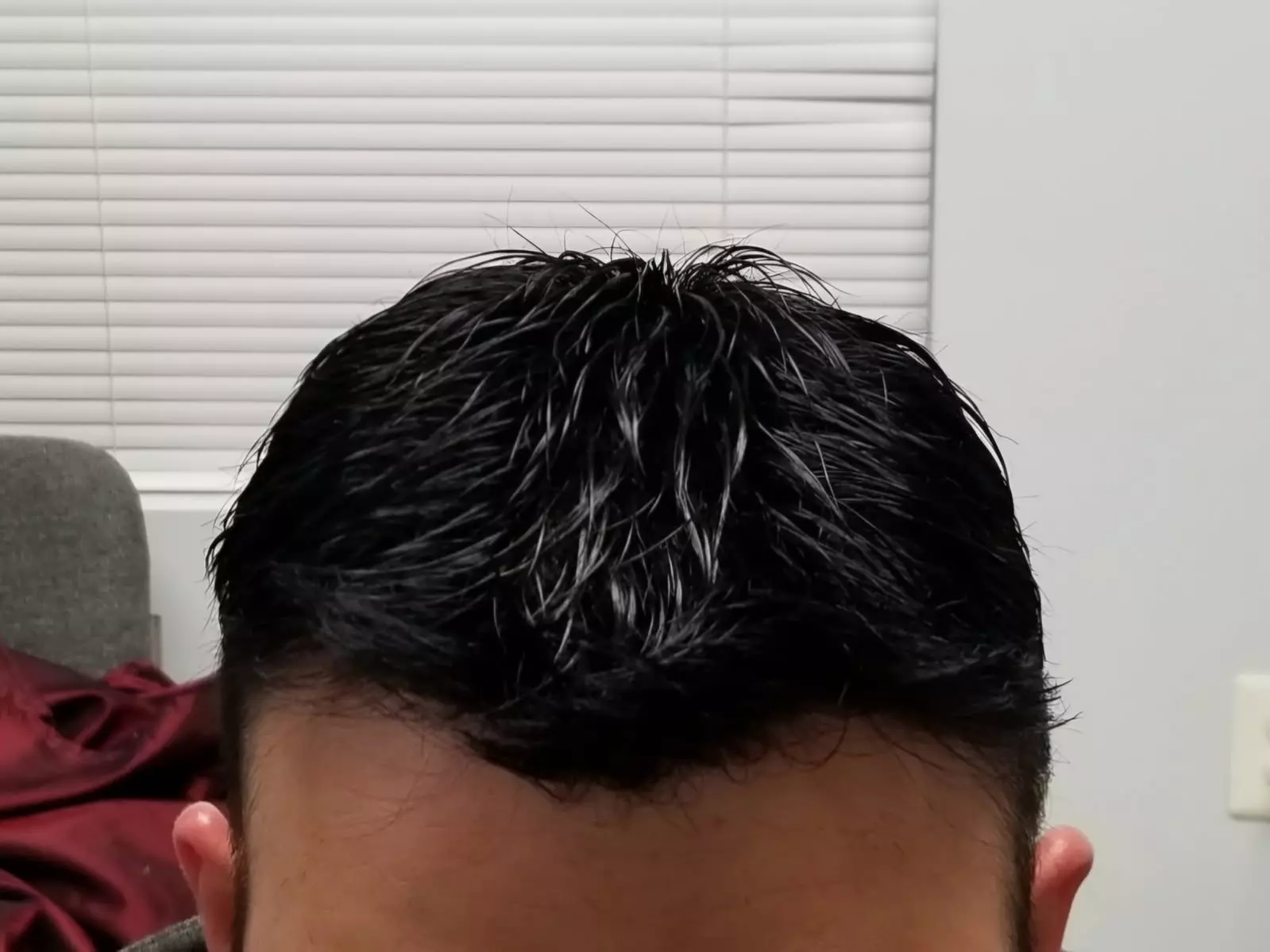 $369 or $265 Worth of Non Surgical Hair Replacement