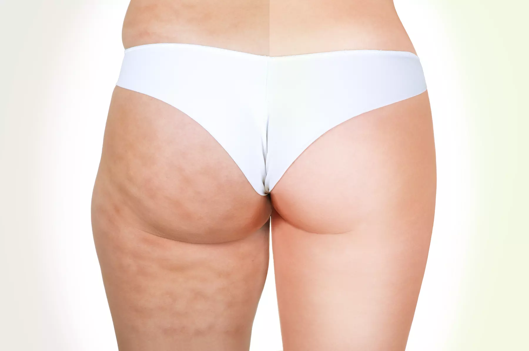 Non-Invasive Lipo Light Treatments for Slimming and Toning