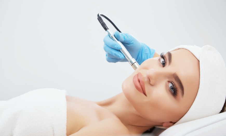 Image 1: Up to 40% Off on Micro-Needling at The Aesthetic Boutique