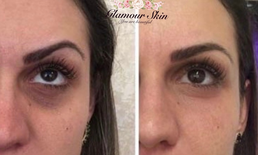 Image 5: Bis zu 43% Rabatt auf Permanent Concealer bei Glamour Skin