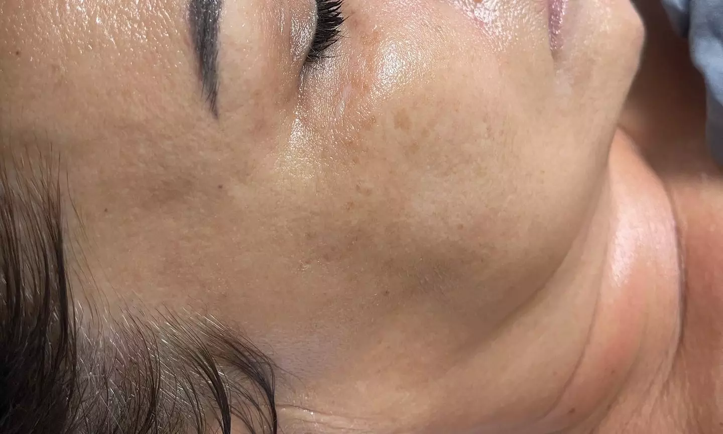 Up to 37% Off on Facial at Lara skincare and beauty - Second Medium