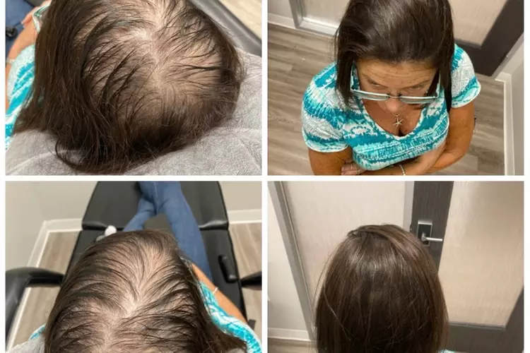 Discover Drscalp Ink's Scalp Micro Pigmentation Options for up to 49% off - Primary Image