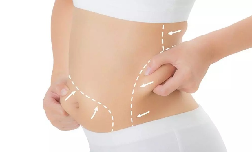 Image 1: One Localized Fat Freezing + Skin tightening at Dr Her Aesthetics