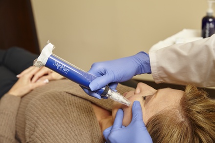 One Microneedling Treatment - Aries Medical Aesthetics