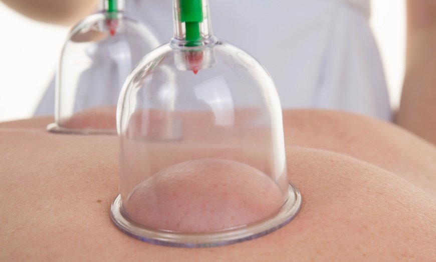 Image 4: Enjoy One, Three or Six One-Hour Sessions of Cupping Treatment