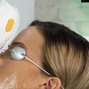 Image 2: Revitalize Your Skin: 1 or 3 IPL Photofacials Sessions at Bye 2 Hair
