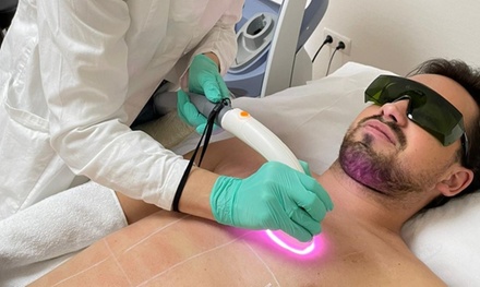 Eine ACHSEL Dioden Laser-Haarentfernungs-Sitzung für Frauen Vakuum-Technologie