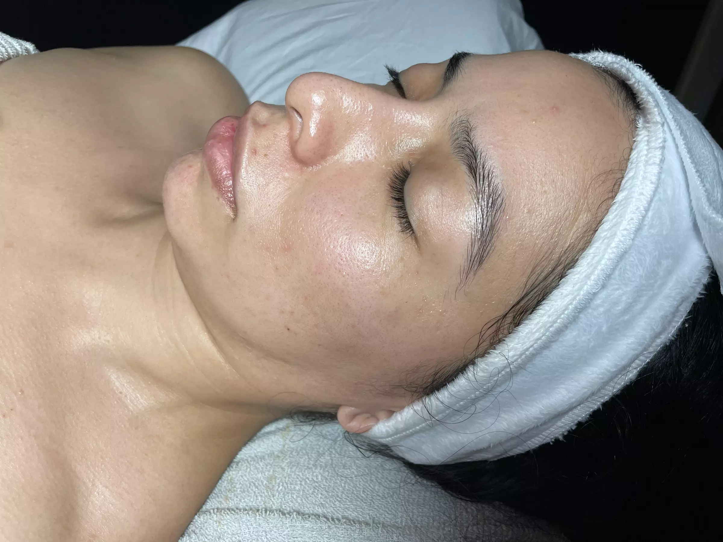 Transform your skin at Body and Skin by Ela with a 90 minute Dermaplane Facial, offering up to 50% off - Primary Image