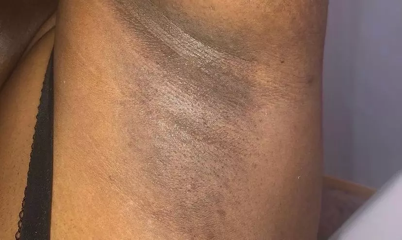 Get Smooth with Full Leg, Brazilian, or Lower Legs Wax Options