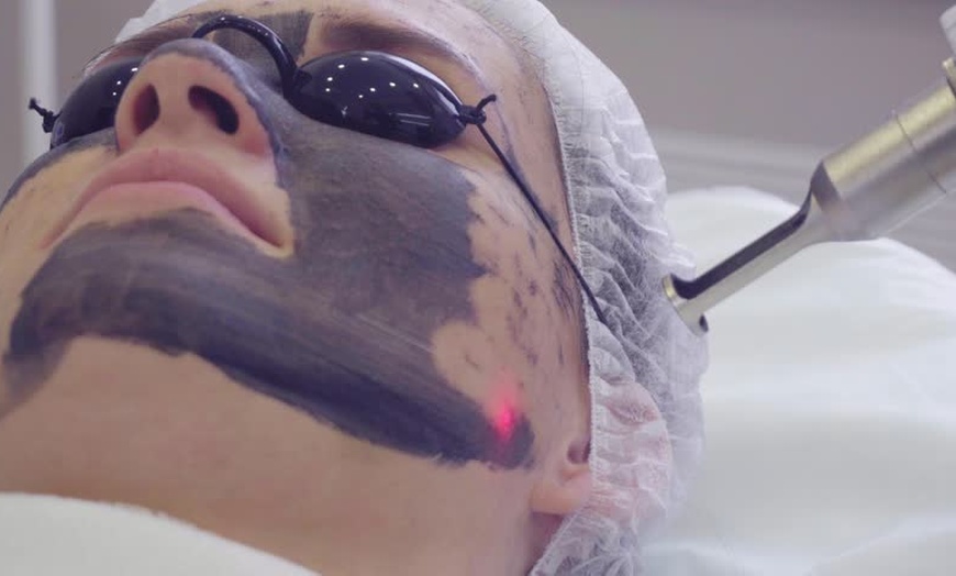 Image 1: Carbon Laser Facial