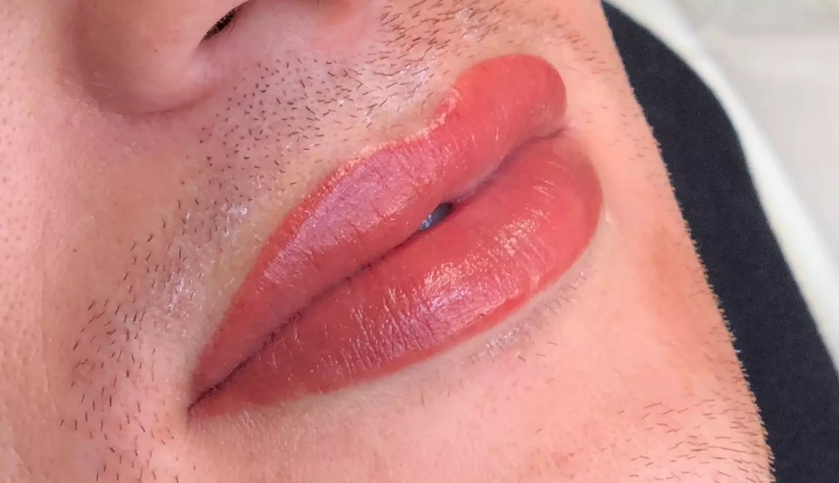 Up to 43% Off on Lip Enhancement at Lips By Nada - Primary Image