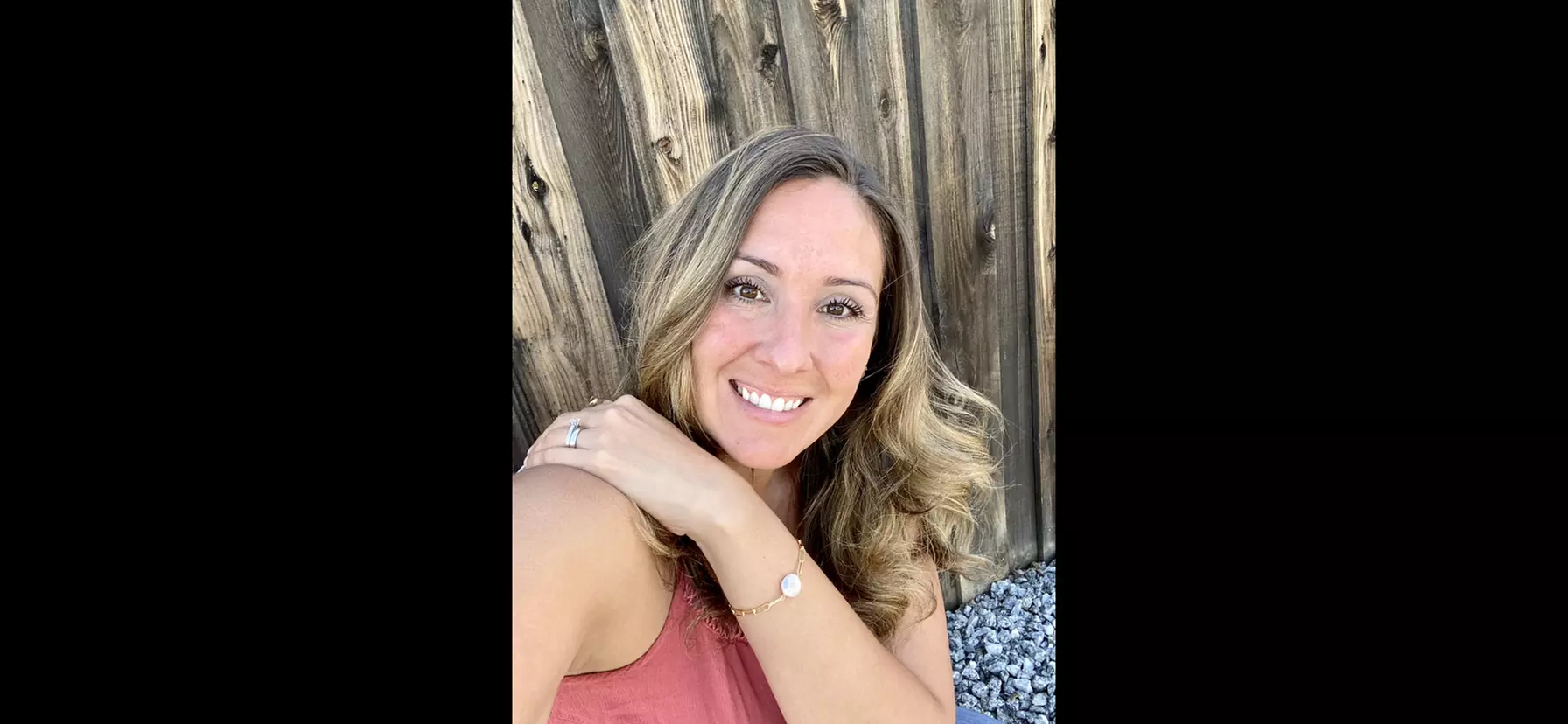 Up to85%Off on Laser Hair Removal at JRNO Wellness Skincare