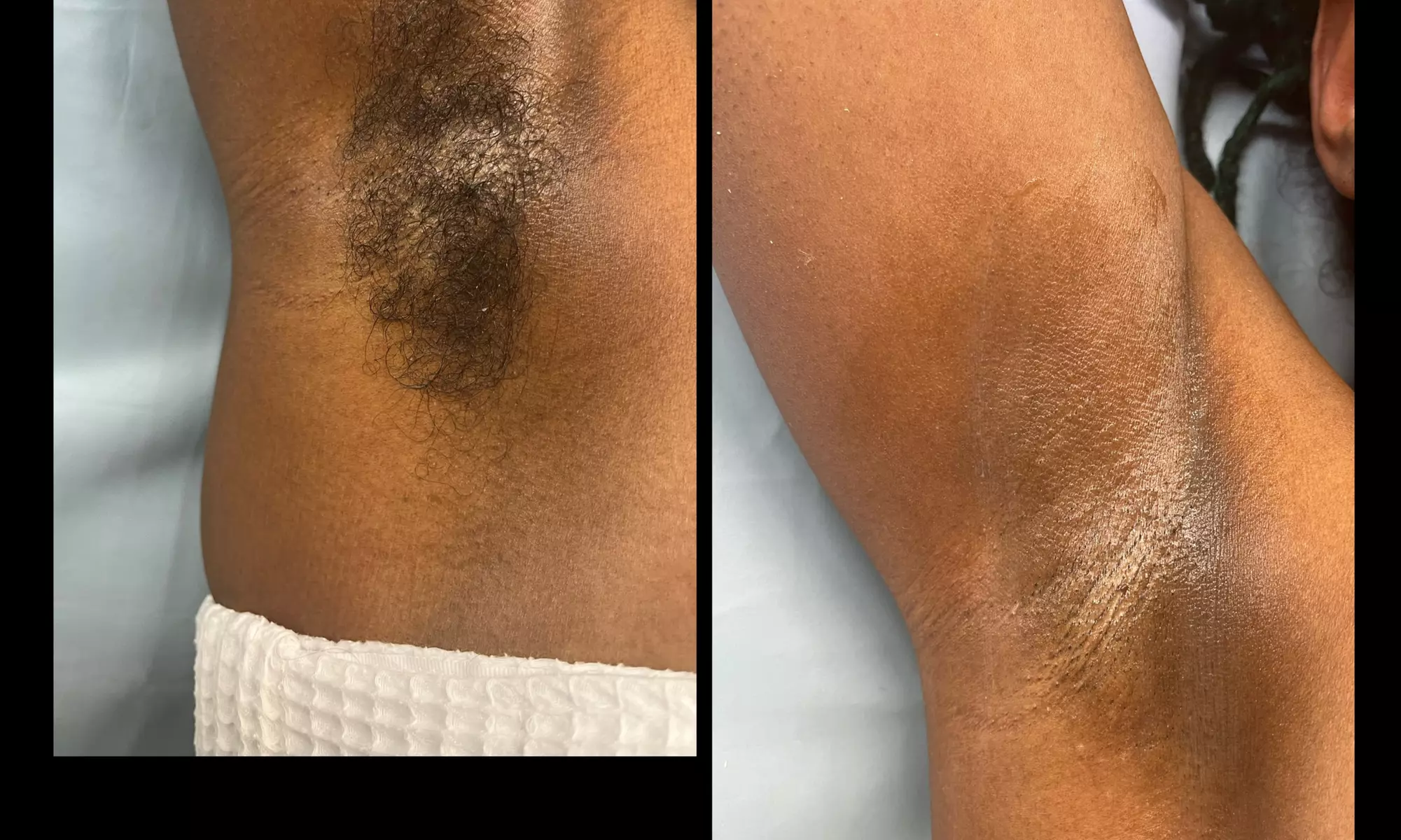 Up to 20% Off on Waxing at Enae Essentials - Primary Image