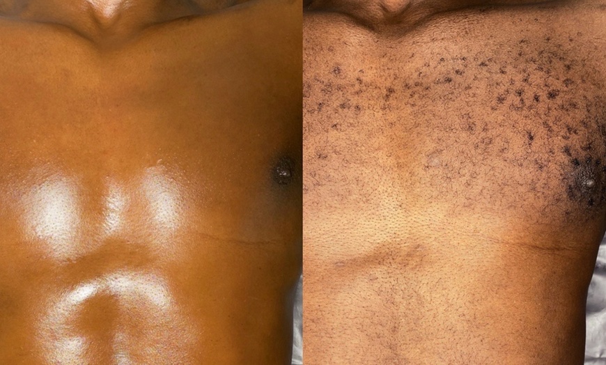 Image 3: Up to 57% Off on Waxing - Men at MamiYaba