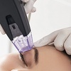Image 1: Revitalize your Complexion with Laser Resurfacing Treatment at Vytal Center (Up To 57% Off)