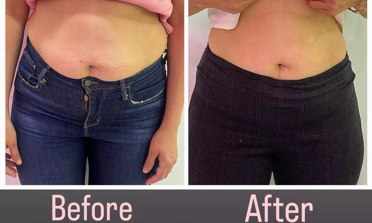 Achieve your goals with Rejuve and Relax MedSpa's 4 Week FDA Approved Weight Loss Injection Program, up to 30% off - Primary Image