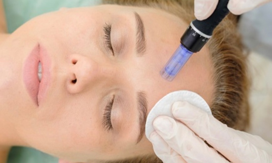 Image 2: Up to 54% Off on Facial - Exfoliating at Skin Esthetics Clinic