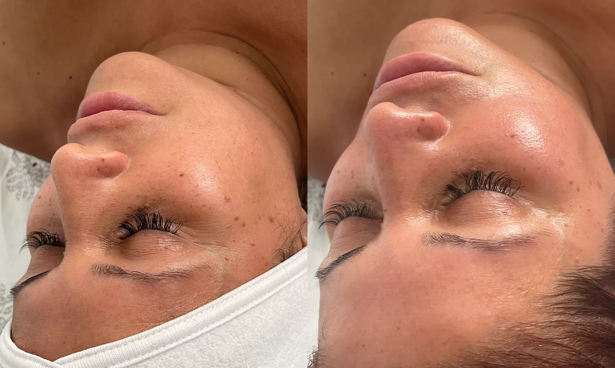 Up to 44% Off on Anti-Aging Facial at Q’kare beauty - Primary Image